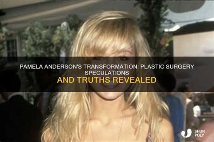 Has Pamela Anderson Had Plastic Surgery