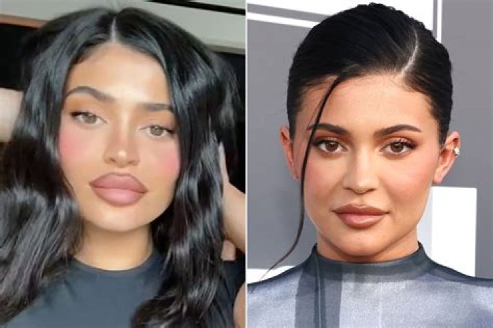 Kylie Jenner Big Lips