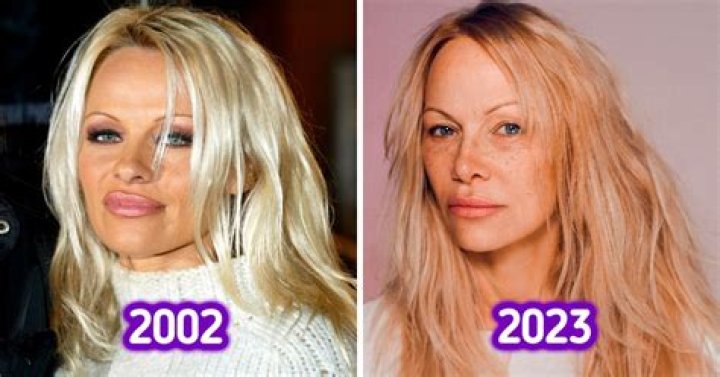 pamela anderson face timeline